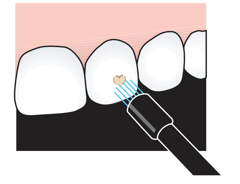 Tooth Gem DIGITAL Course WITH KIT